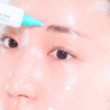 beplain Cicaterol Spot Treatment
