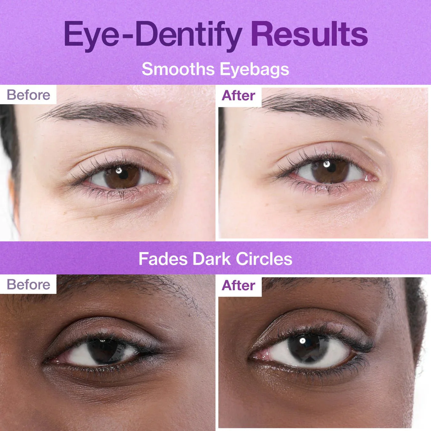 Anti-Aging Lifting Patches No.9 NAD+ Collagen Under Eye Patches 10pcs - Image 4