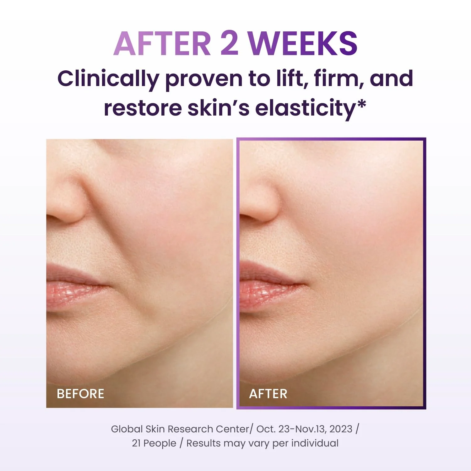 BIOHEAL BOH Probioderm 3D Lifting Skin Care 3P Special Set | Healthyskin.ee